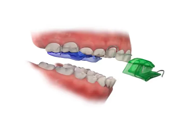 Duncan Dental Twinblock