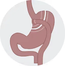 Bay Surgery Bypass