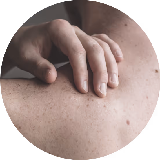Bay Surgery Skincancer