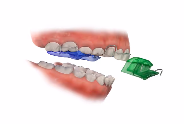 Duncan Dental Twinblock